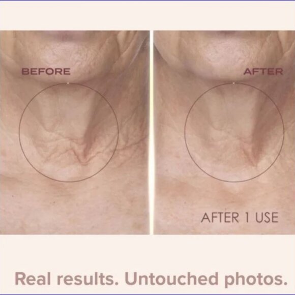 CREPE ERASE TruFirm Complex Intensive Body Repair Treatment - 10oz / 285g NWT - Picture 6 of 10